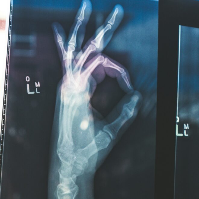 Google’s open MedGemma AI models could transform healthcare