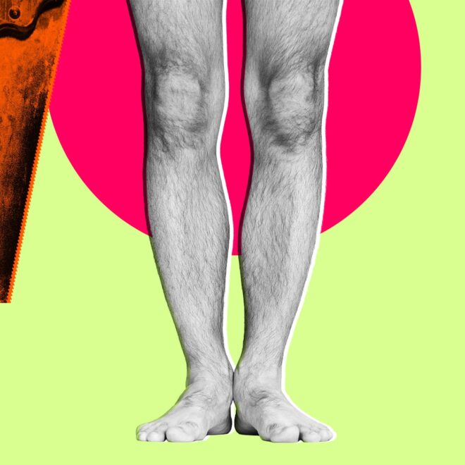 Surgeon Accused of Getting His Own Legs Cut Off for Insurance Reasons
