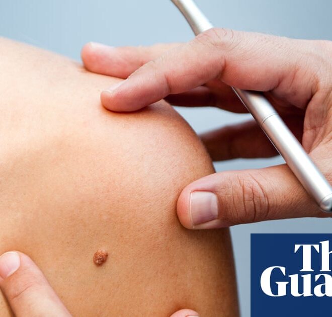 Be warned about the dangers of tanning | Skin cancer
