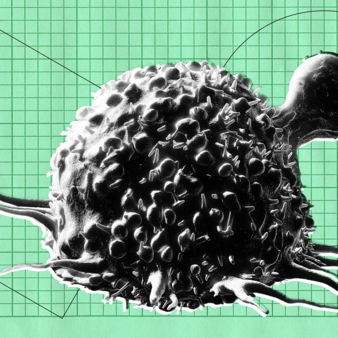 Doctors Using AI Quickly Lose Ability to Spot Cancer, Study Finds