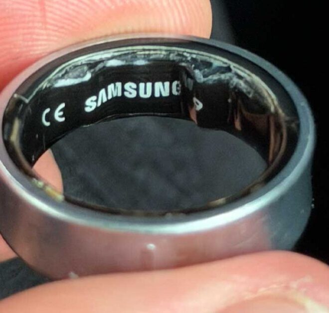 Swollen Galaxy Ring battery leads to hospital visit