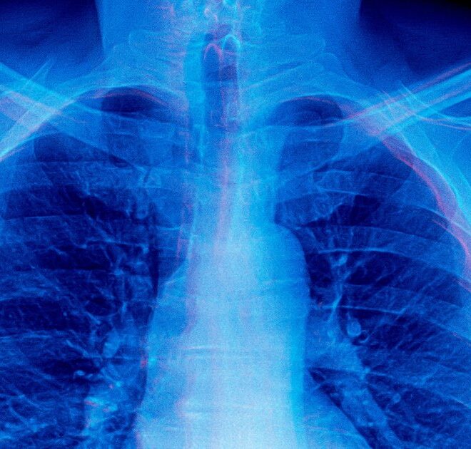 Frontier AI Models Are Doing Something Absolutely Bizarre When Asked to Diagnose Medical X-Rays