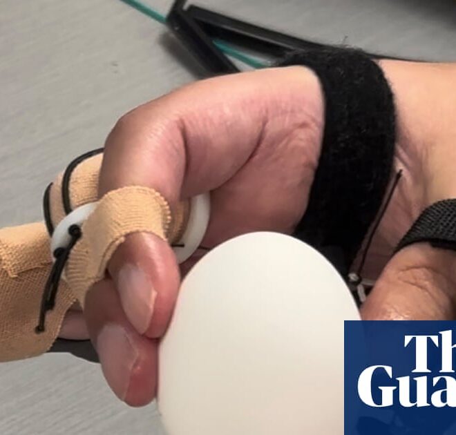 Brain implant helps paralysed man to feed himself and drink from cup | Neuroscience